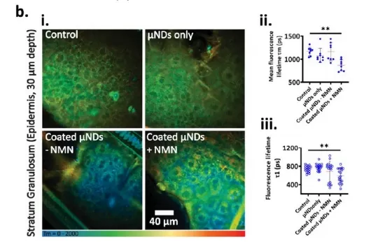 Effects of NMN Treatment on Skin Cell Metabolism Effects of NMN Treatment on Skin Cell Metabolism