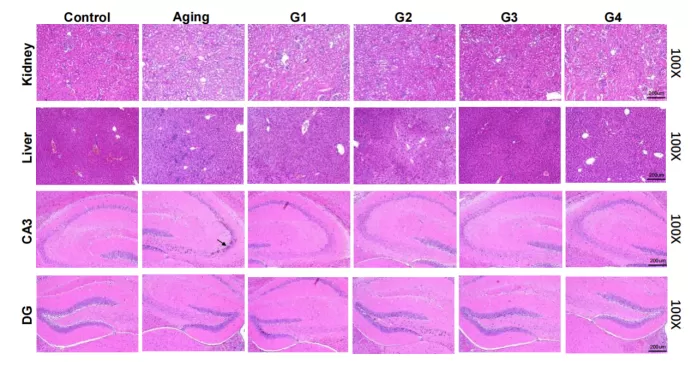ผลลัพธ์ที่น่าสนใจในรูปแบบริ้วรอยตามธรรมชาติ