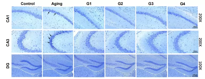 Compelling Results in the Natural Aging Model