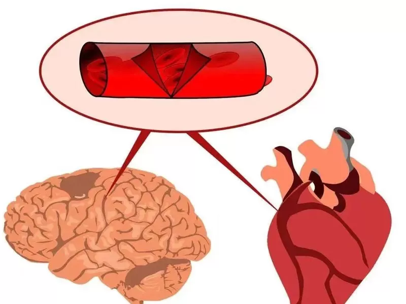 ชุดต่อต้านริ้วรอย: Resveratrol
