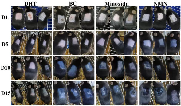 Nmn และการเจริญเติบโตของเส้นผม: หลักฐานใหม่ใน androgenetic alecia (AGA)